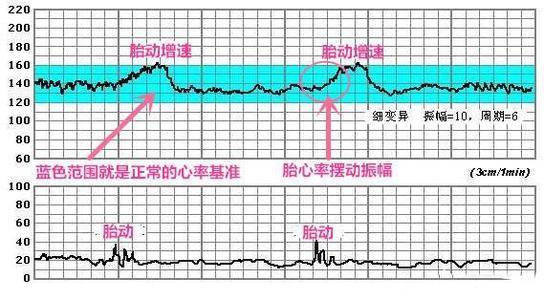 几个月可以自己测胎心几个月可以自己测胎心？了解孕期胎心监测的重要性与方法